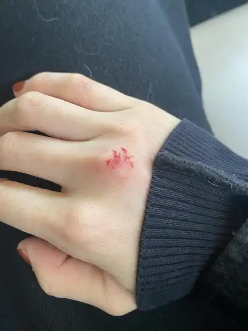 安抚他都软硬不吃;就在我打算再擦一遍,伸手抓他脚的时候被撇头一口