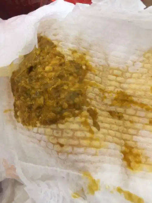 愉快!新生儿大便颜色"活灵活现"-第2张图片-凯飞博客