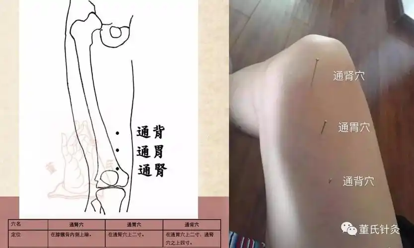 【穴位位置图】【上三黄,下三皇,通肾通胃通背,制污穴,止涎穴】只要