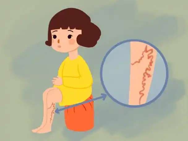 为啥有些人手臂"青筋暴起",有人却看不到"青筋",看完了解了