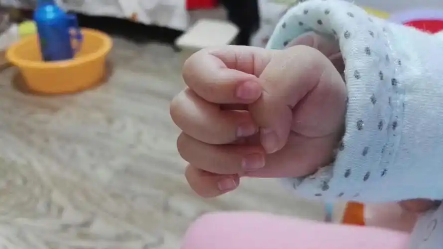 两个月宝宝两只手的拇指都内扣,伸直的时候只有四个手指,握拳的时候