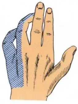 知识点8:猿猴手掌是平的,没有对掌肌,所以,正中神经损伤之后就形成了