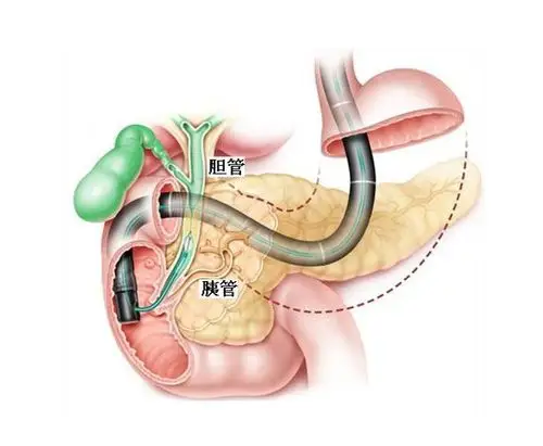 人体胆管结构示意图-生理结构图