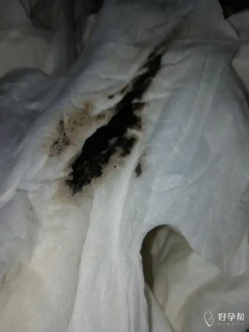 10位医生回答 2018-08-12 17:44:17 819 10 收藏举报 其他回答 可能