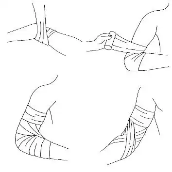 绷带包扎方法