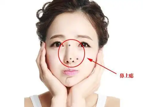 女人鼻子左侧旁边有痣代表什么富贵之相