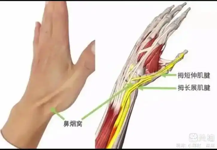 附上手部腱鞘位置图(图上两个肌腱的位置发生疼痛就是腱鞘炎),手疼痛
