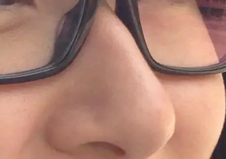 这算不算鼻梁起节?