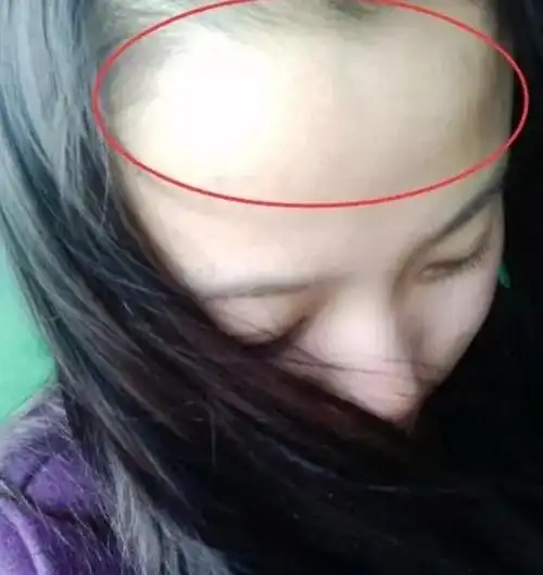 没有化妆的时候额头是亮亮的,额头发亮叫做照夫镜,照夫镜就是照老公