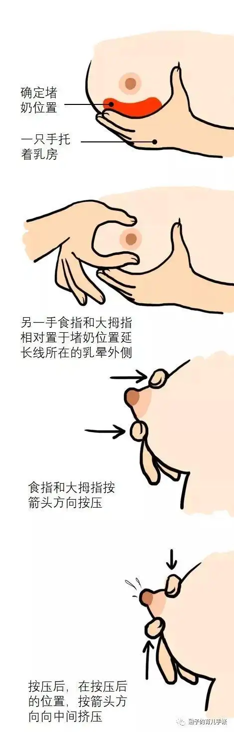 接着,一手托着乳房,另一手顺着堵奶的位置用如图所示的方法手挤奶.
