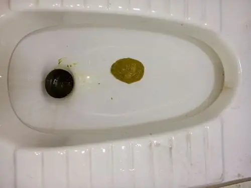 急求帮忙解答一下啊,不要觉得恶心!