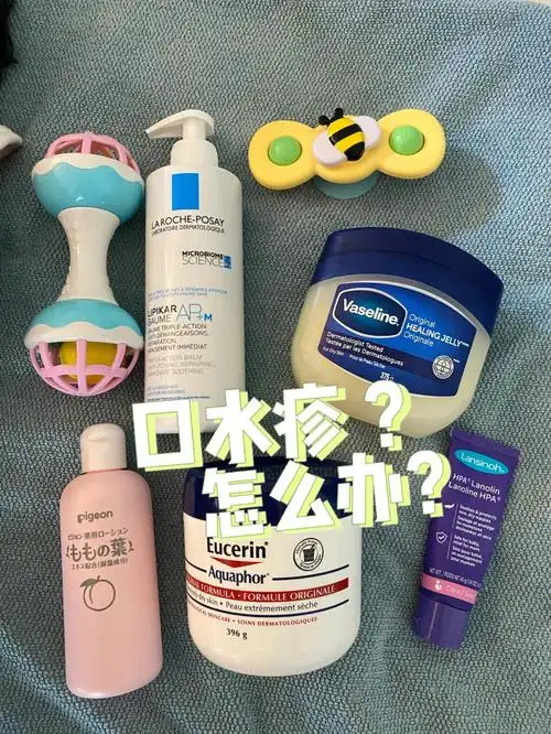 宝宝口水疹怎么办预防治疗口水疹哪家强