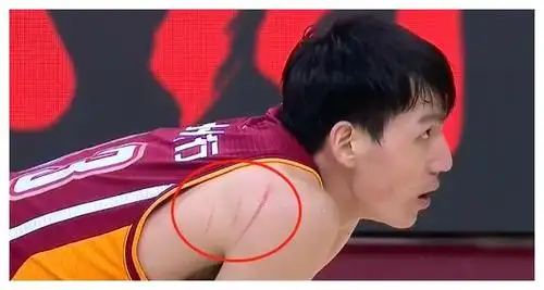 3分差太多了!浙江半场领先15分,吴前爆发15 3 6 手臂上3条血痕