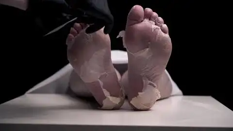 戴着黑色手套的病理学家在尸体的脚上挂上空白的白色标签