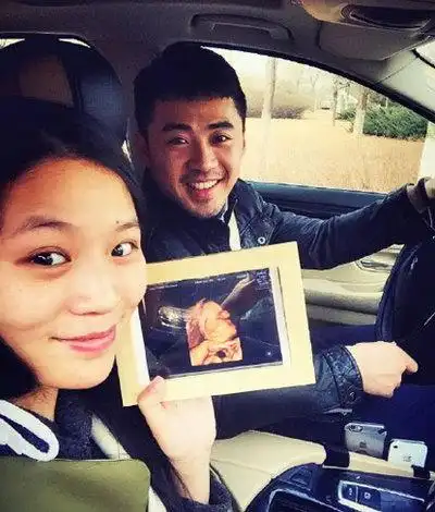 黄英夫妇宝宝b超照