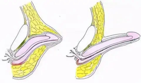 女装大佬宿阳入腹教程图女装大佬推蛋入腹的教程图