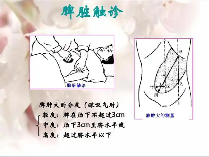 脾脏触诊 脾肿大的分度(深吸气时) 轻度:脾在肋下不超过3cm 中度:肋下