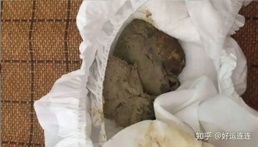 " "宝宝近来拉的大便有奶瓣,会不会影响健康?" "宝宝便血