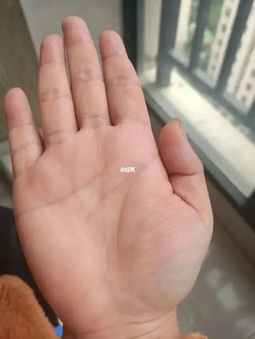 智慧线突然好多分叉