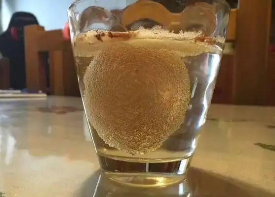 醋泡鸡蛋,不用怕膝盖滑膜炎治不好!用一个好一个,100000加收藏