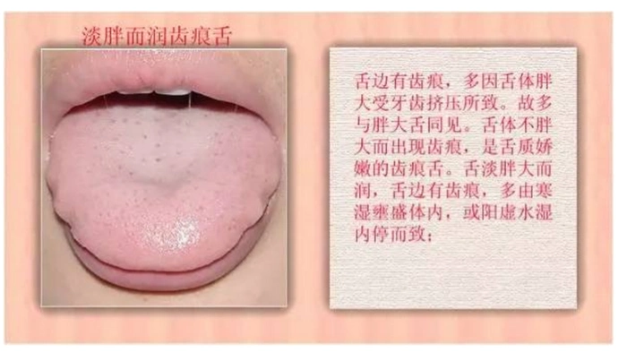 人体的九种体质及舌诊图谱!
