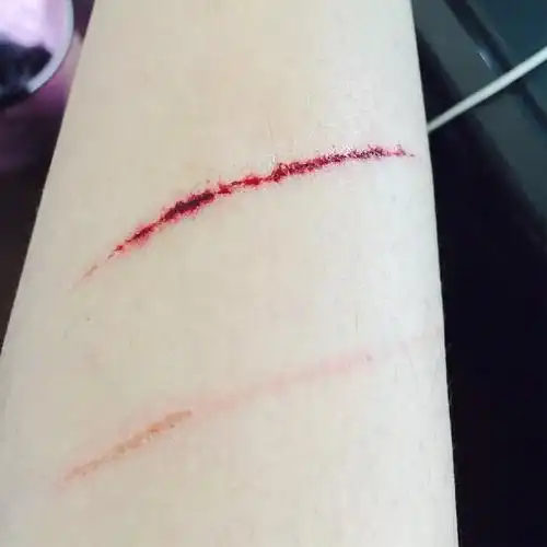 被自己狗指甲抓破出血需要打破伤风吗