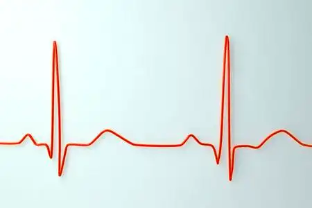 心电图在明亮的背景上照片