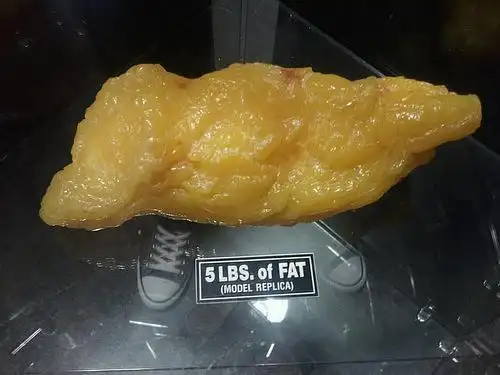 这个是我们mt camp前台展示的,5磅脂肪有多大一团