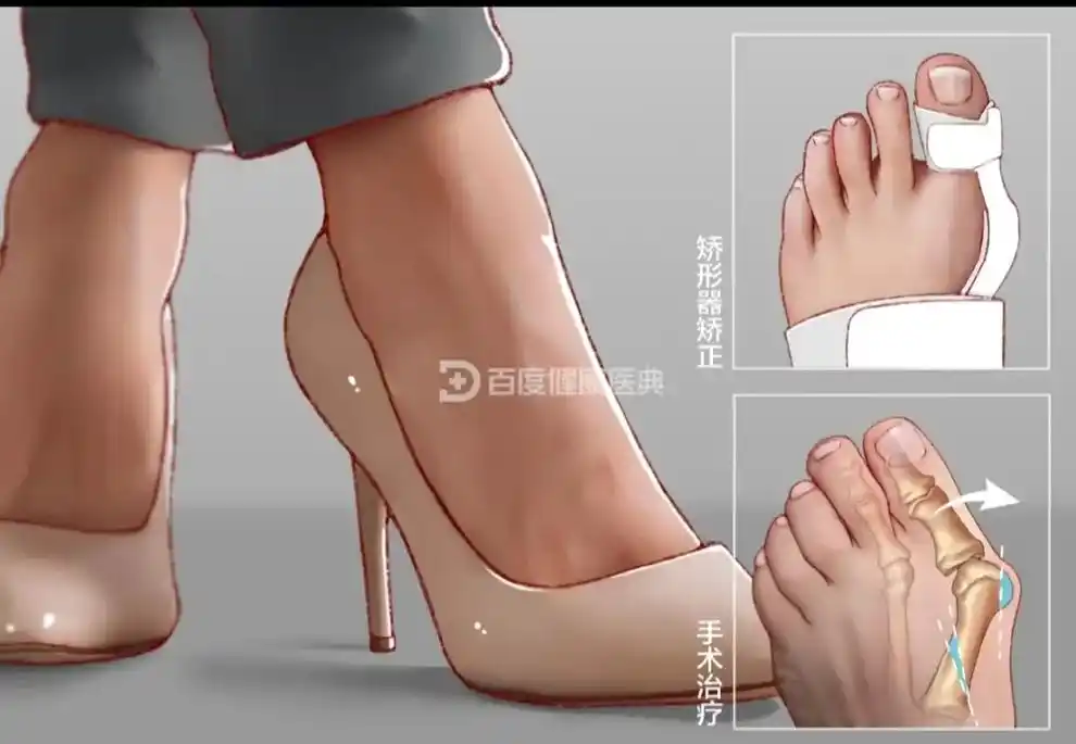 姐妹们,不管亲是埃及脚还是希腊脚或者是罗马脚,女人这三种脚形 - 抖