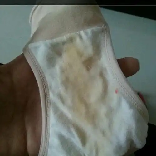 孩子内裤经常湿一片正常吗孩子内裤总是湿的