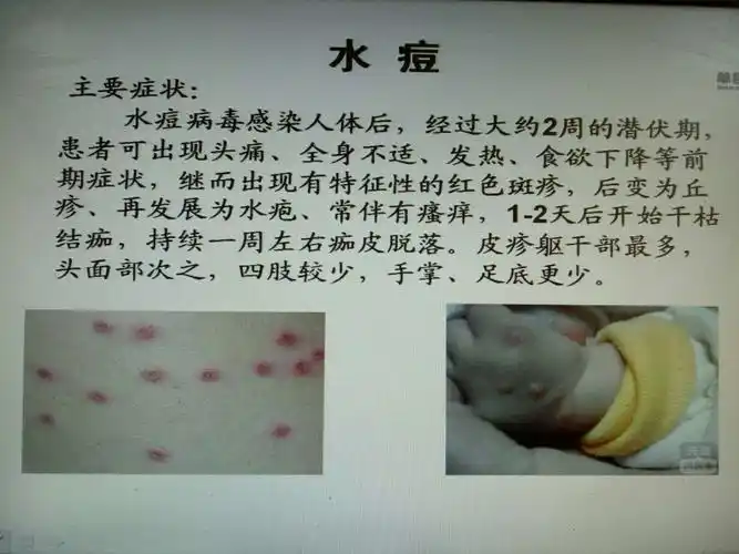 比较常见的有水痘,流行性腮腺炎,风疹,手足口病等.