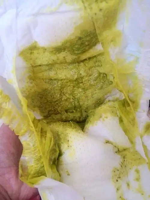 有点稀,是拉肚子么?