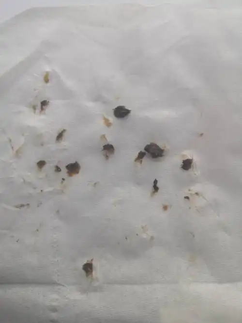 油性耳屎怎样清理