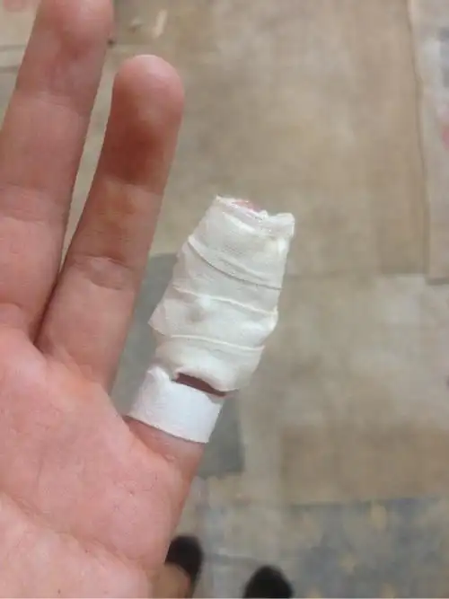 我们要及时用纱布进行包扎.