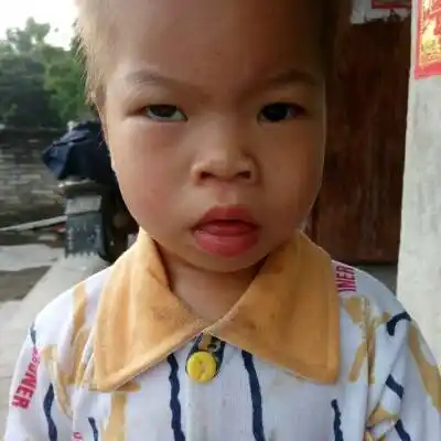 看一下这个小孩是不是唐氏儿