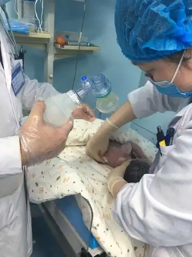 医生正在对宝宝进行吸痰,刺激等复苏操作