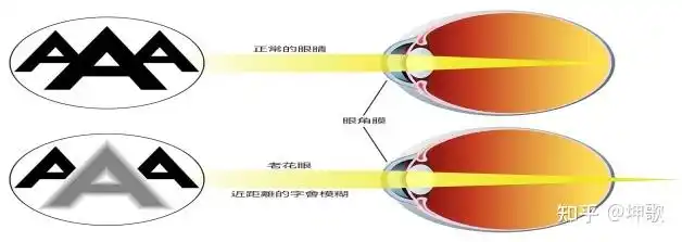 老花戴镜优缺点