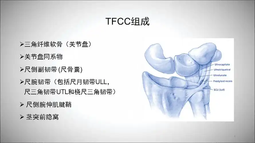 (优质医学)关节镜下治疗三角纤维软骨复合体损伤.ppt