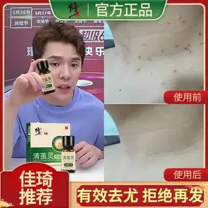 803人付款淘宝疣瘊肉粒一抹无忧疣必净疣瘊平软膏祛去肉粒疣必治滇