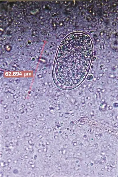显微镜下寄生在这批走私穿山甲身上的寄生虫