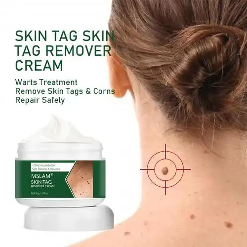 跨境速卖通祛疣膏平疣霜鸡眼点痣克疣膏肉粒软膏skin tag remover
