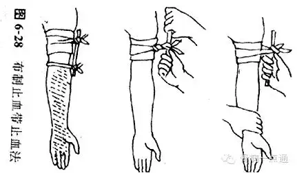 急救止血包扎,建议收藏学习