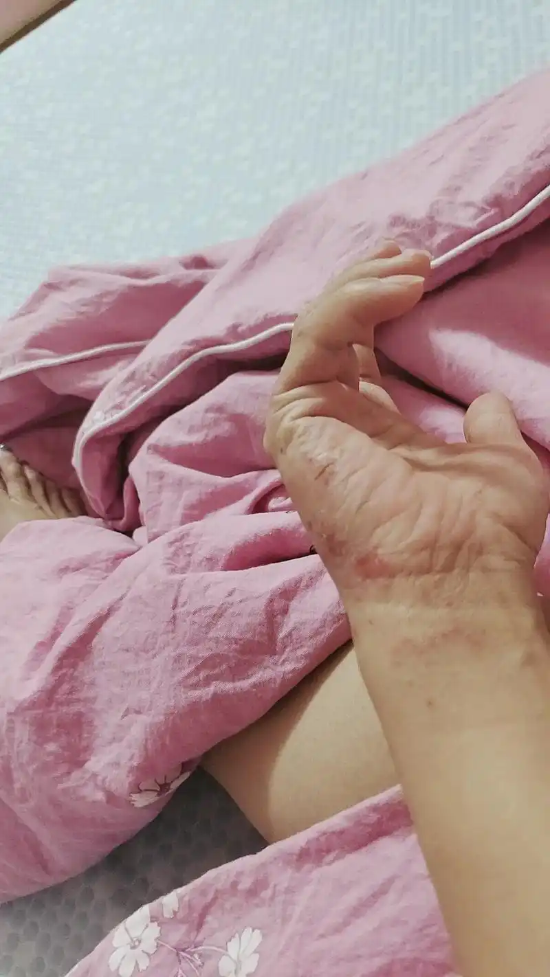 30多岁的手成这样,上班一见水就痛,洗衣服一见洗衣粉就痛,每 - 抖音