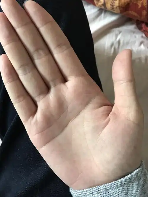 男孩手掌"断掌",有啥说法?