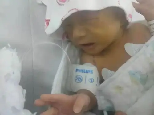 救助信息满月四斤早产宝贝远离家和妈妈只为生的希望