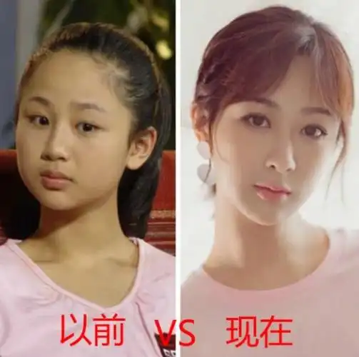 当童星长大后杨紫关晓彤变化大最后一个让人心疼