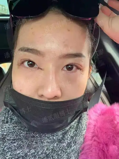 四川女子整容失败:我当初就不应该去开内外眼角,做多了只会变丑