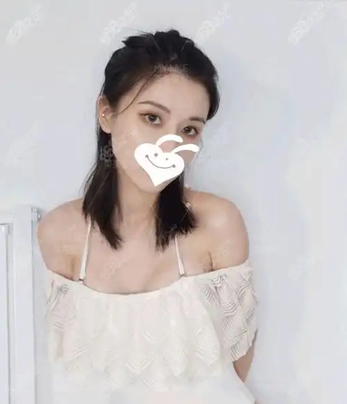 顾客在杭州美莱做完傲诺拉隆胸半年后的效果.jpg