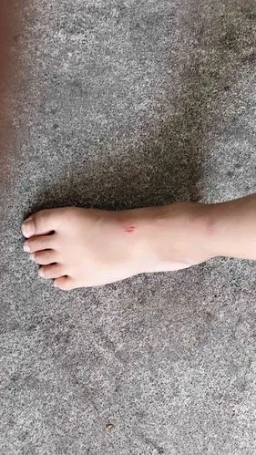 小宝的脚在水里玩的时候受伤了,还告诉我一点都不痛.