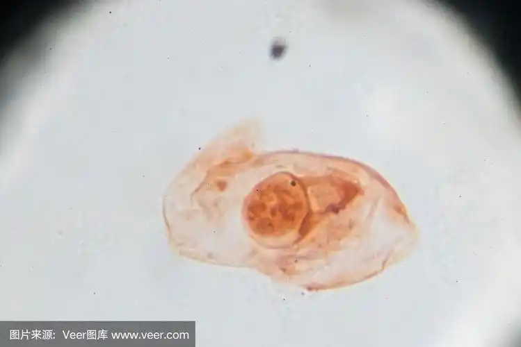 猪带绦虫卵的光镜观察